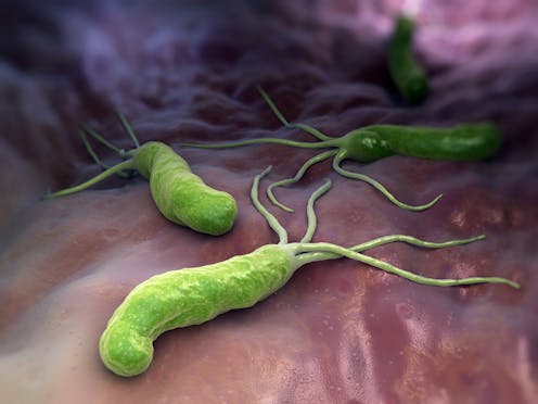 Explainer: what is Helicobacter pylori?
