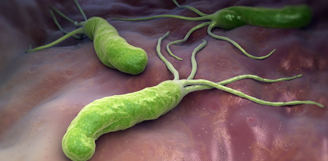 Explainer: what is Helicobacter pylori?