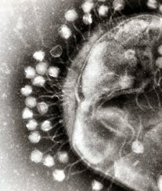 Meet the trillions of viruses that make up your virome