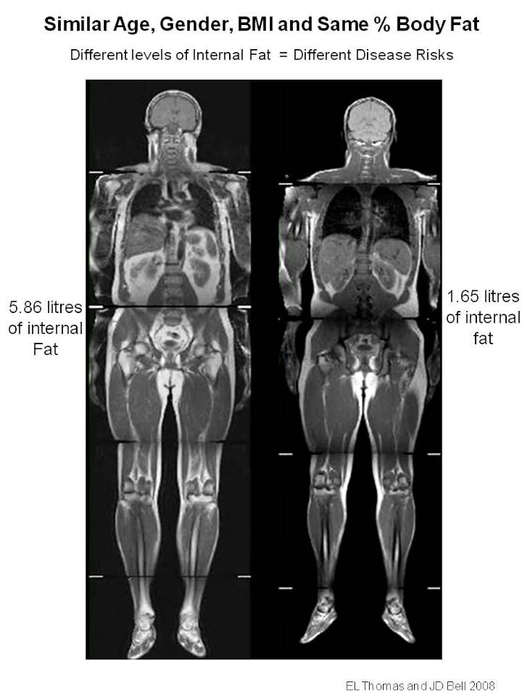 Welcher BMI ist gut?
