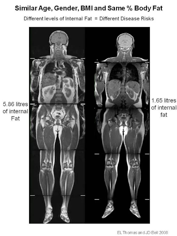 Stop Measuring Obesity With A Ruler We ve Found A Much Better Way Stop Measuring Obesity With A Ruler We ve Found A Much Better Way