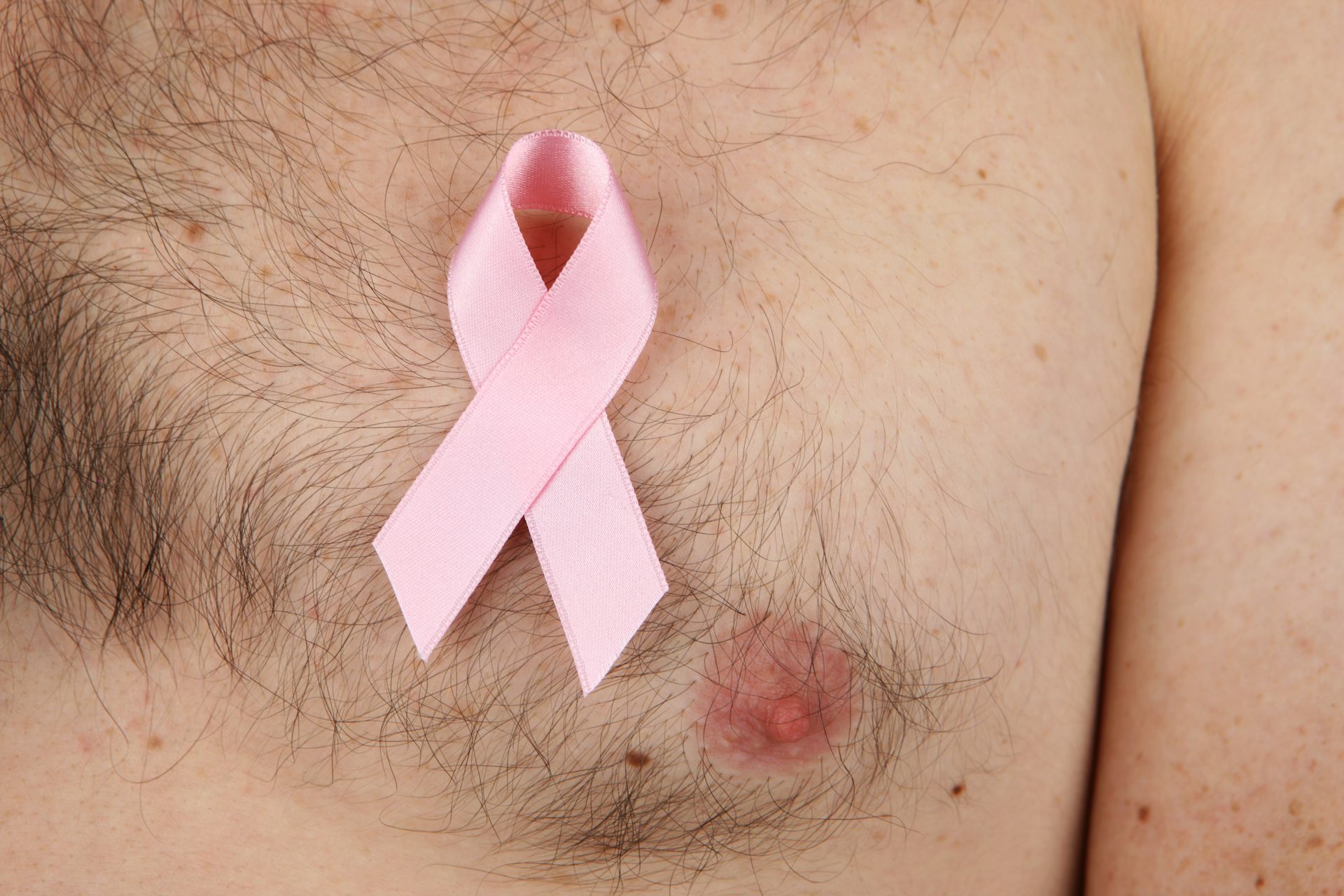 симптомы опухоли груди у мужчин (120) фото