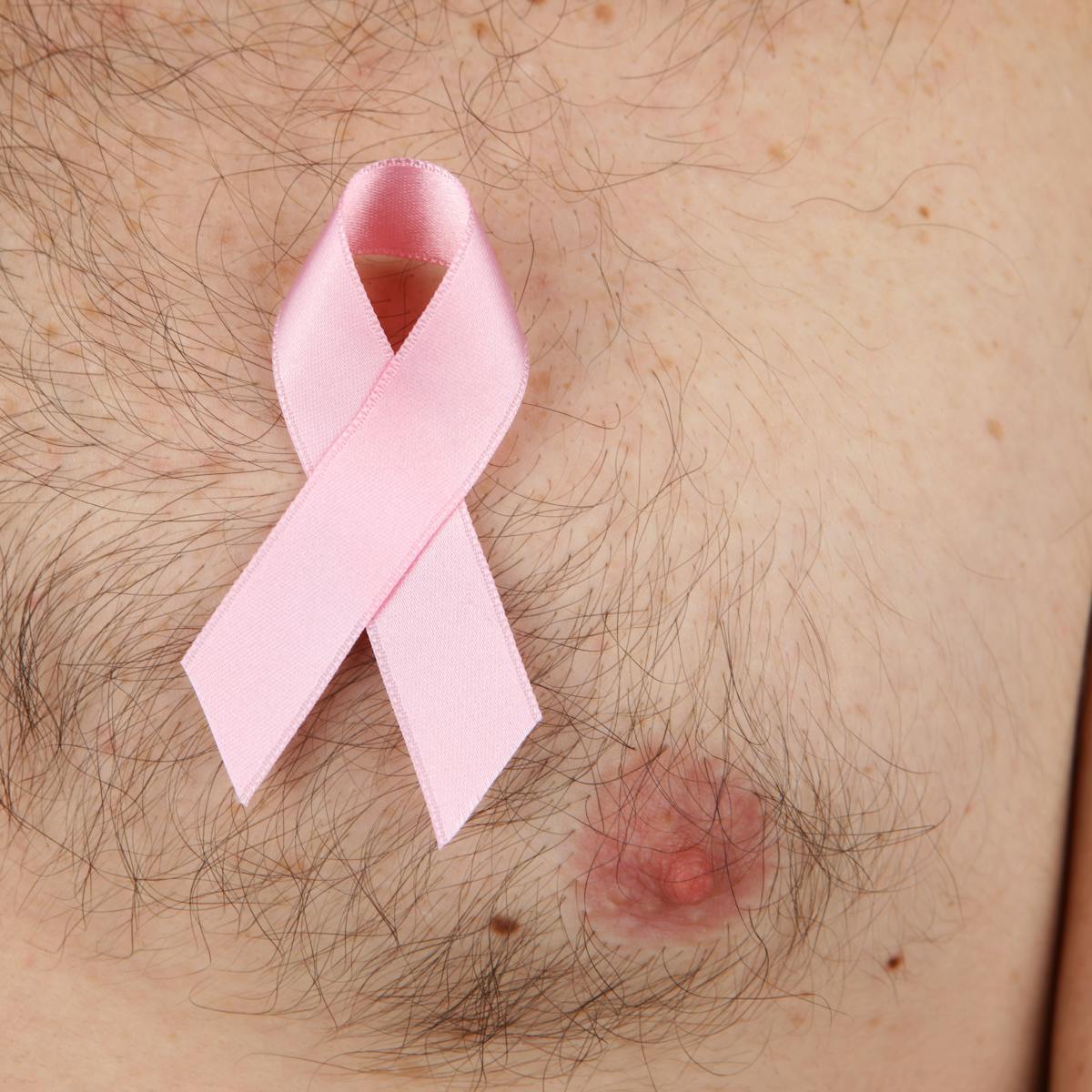Stop marginalising men with breast cancer