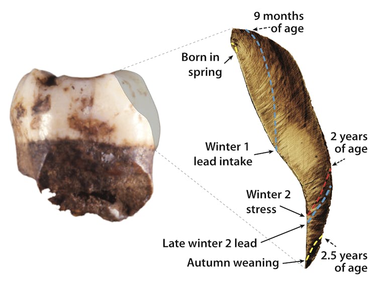 What teeth can tell about the lives and environments of ancient humans and Neanderthals