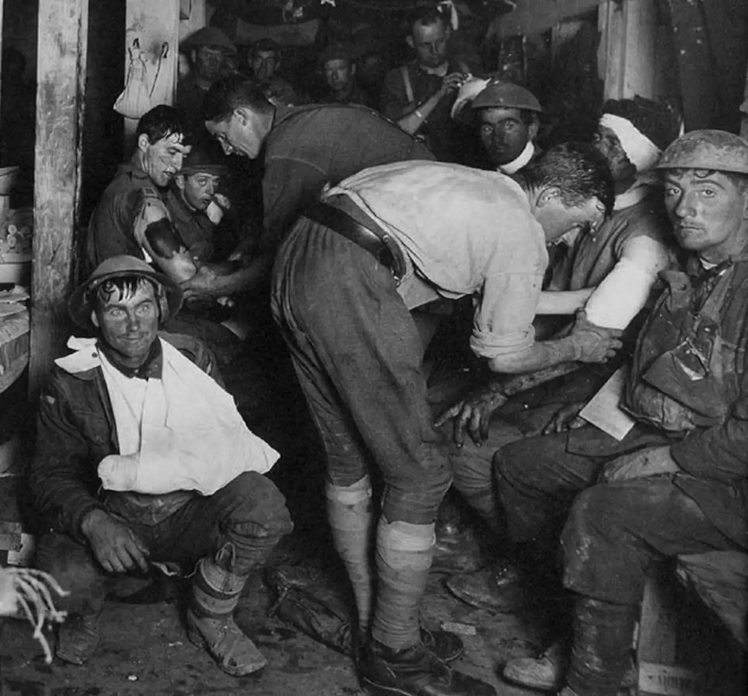 Wwii Injuries What World War I taught us about PTSD