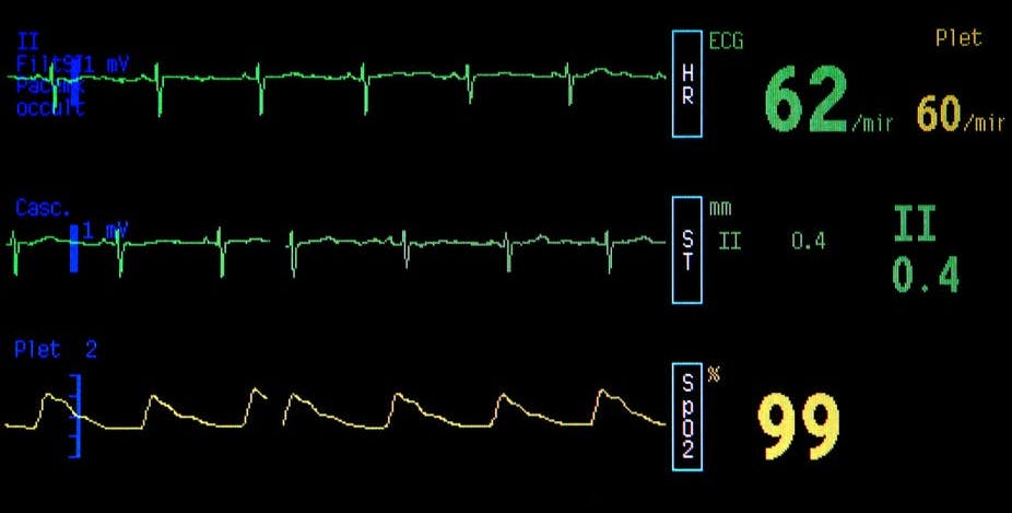 Hacktivisme Et Cause A Defendre Cad Forces Faiblesses