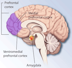 Developing teen brains are vulnerable to anxiety – but treatment can help