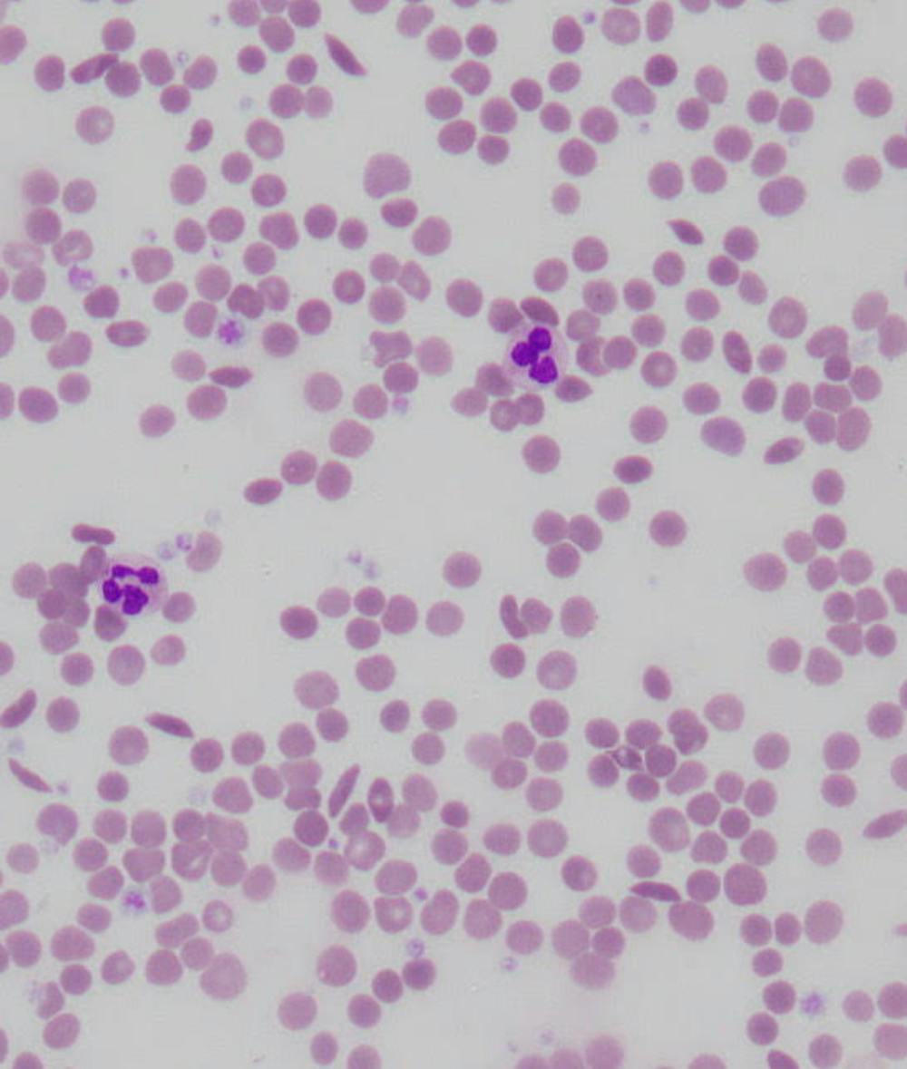How our red blood cells keep evolving to fight malaria