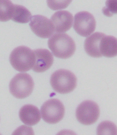 How our red blood cells keep evolving to fight malaria