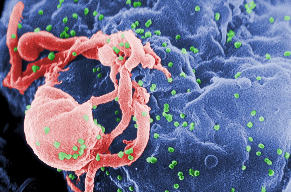 Is there a treatment for hiv