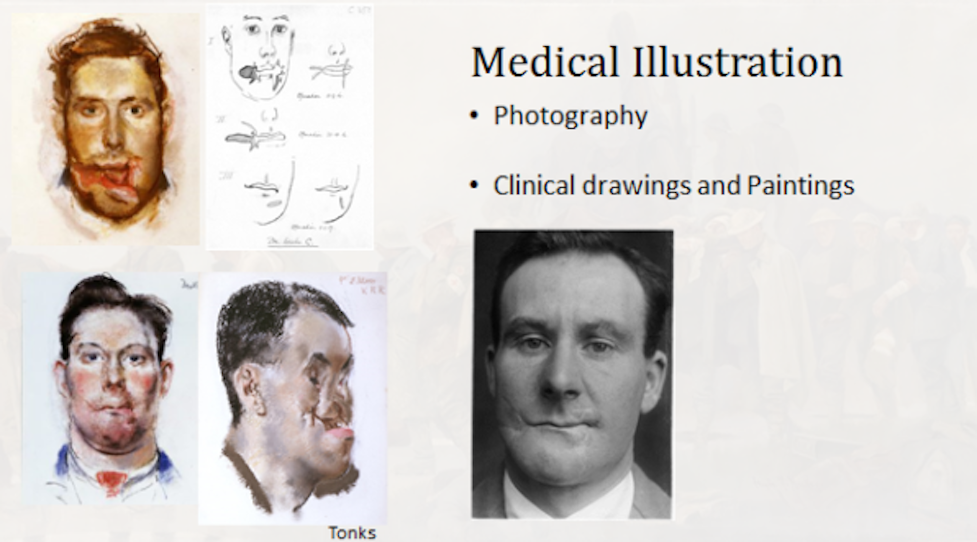 Plastic surgery tube search videos