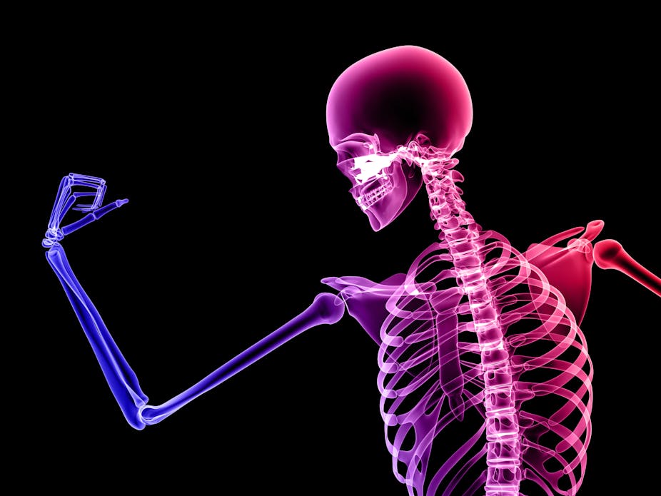 Stronger skeletons in kids depend on which sports they choose