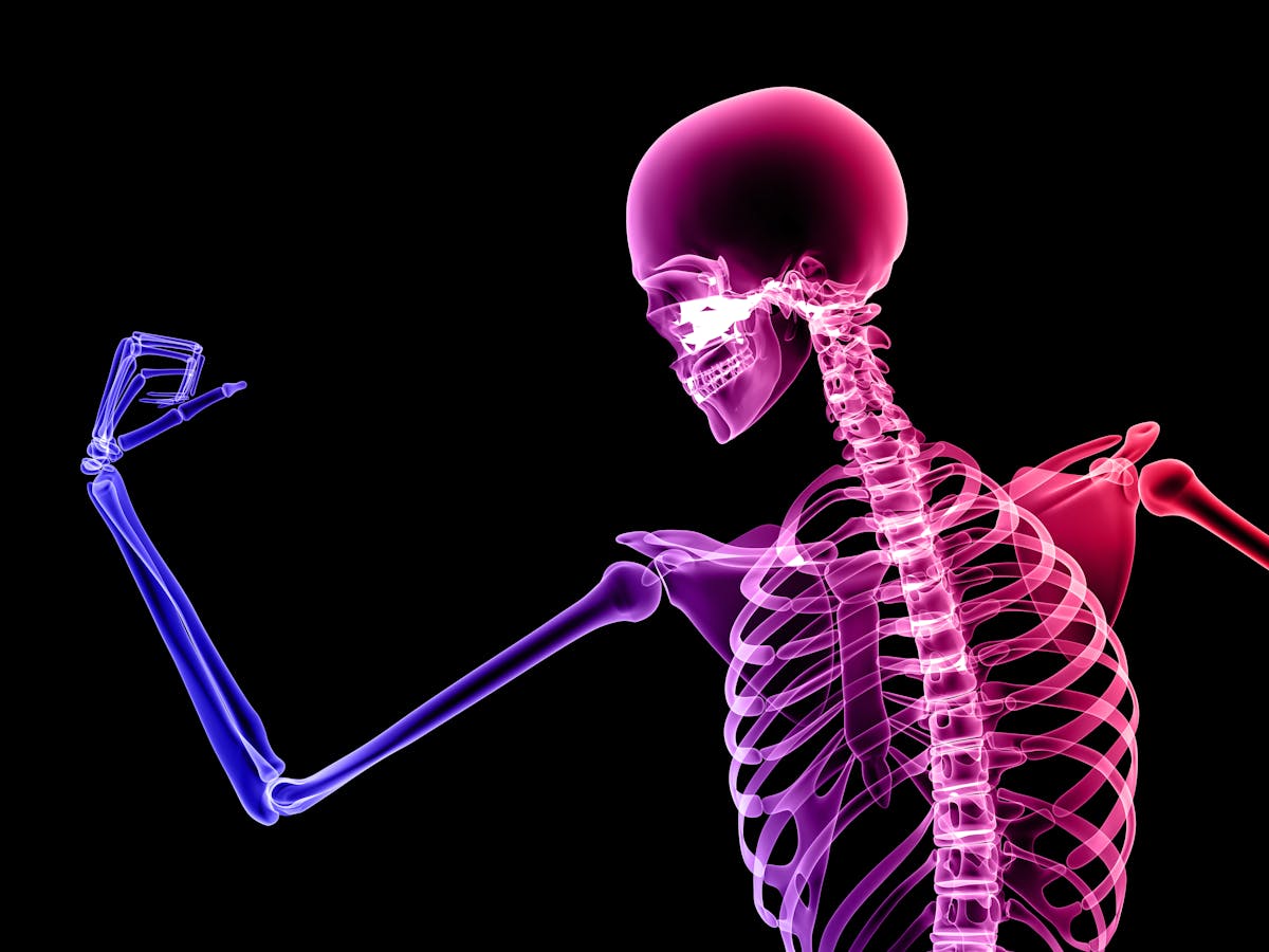 We have weaker bones than our hunter-gatherer ancestors – this is what you can do about it We have weaker bones than our hunter-gatherer ancestors – this is what you can do about it