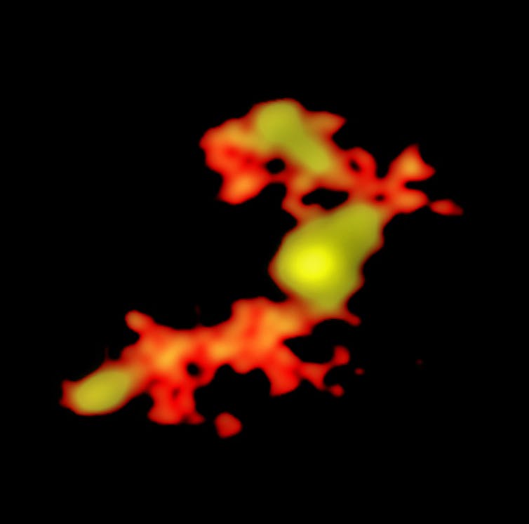 ALMA image of W2246-0526 and its companions feeding it through trans-galactic streamers. T. Diaz-Santos et al.; N. Lira; ALMA (ESO/NAOJ/NRAO)