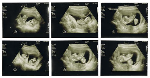 Researcher claims CRIPSR-edited twins are born. How will science respond?