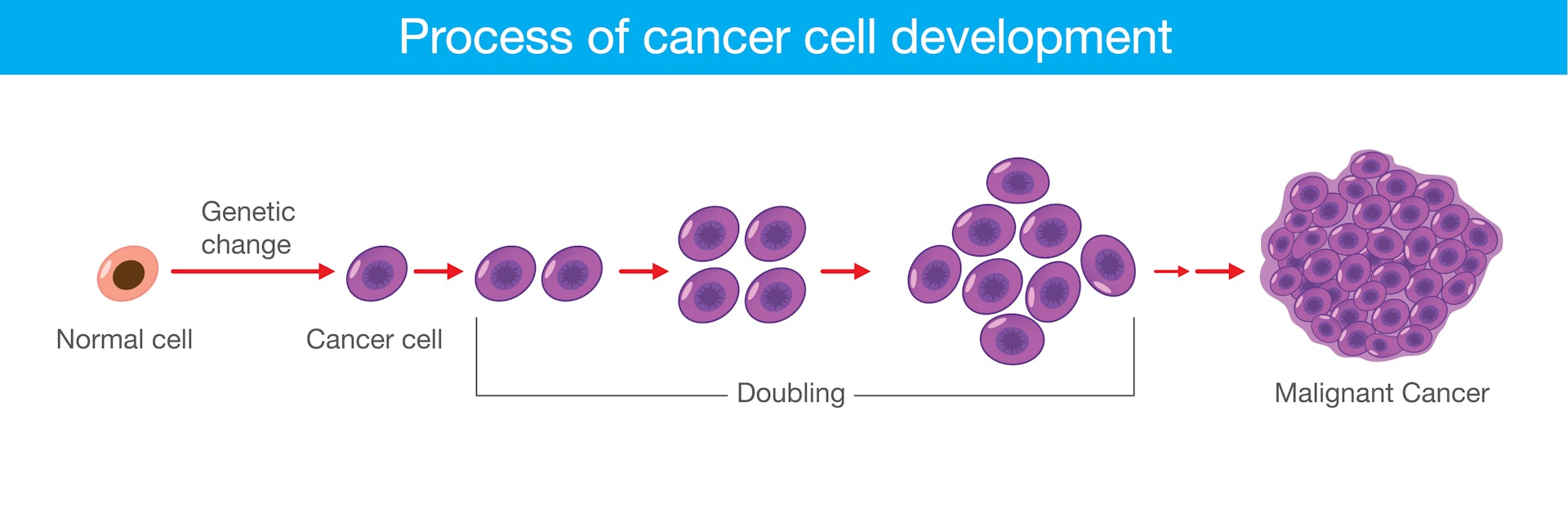 Emilycc Cancer