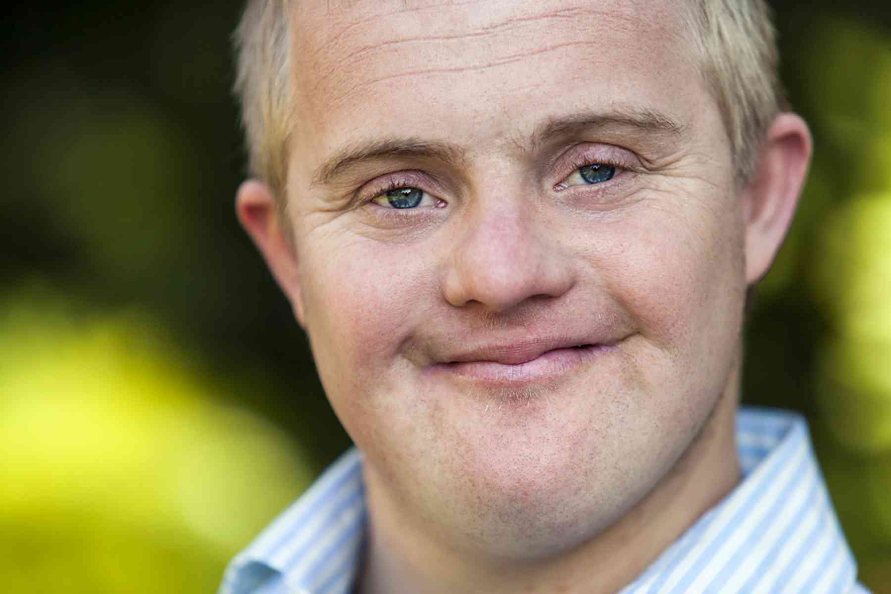 Alzheimer’s: drug trials for preventing the disease in people with Down syndrome may soon be possible – here’s why