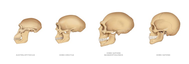Ada perbedaan yang jelas dalam ukuran dan bentuk tengkorak pada Homo sapiens dibandingkan dengan spesies mirip manusia lainnya seperti Homo erectus (skema tengkorak).from www.shutterstock.com