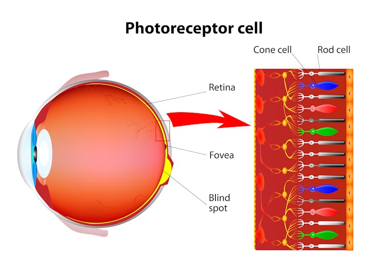 why are people colour blind?