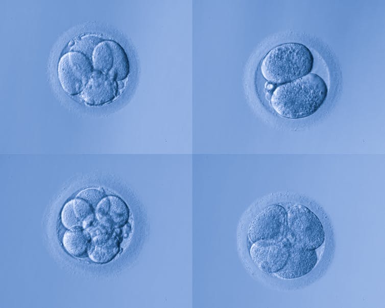 'Designer' babies won't be common anytime soon – despite recent CRISPR twins