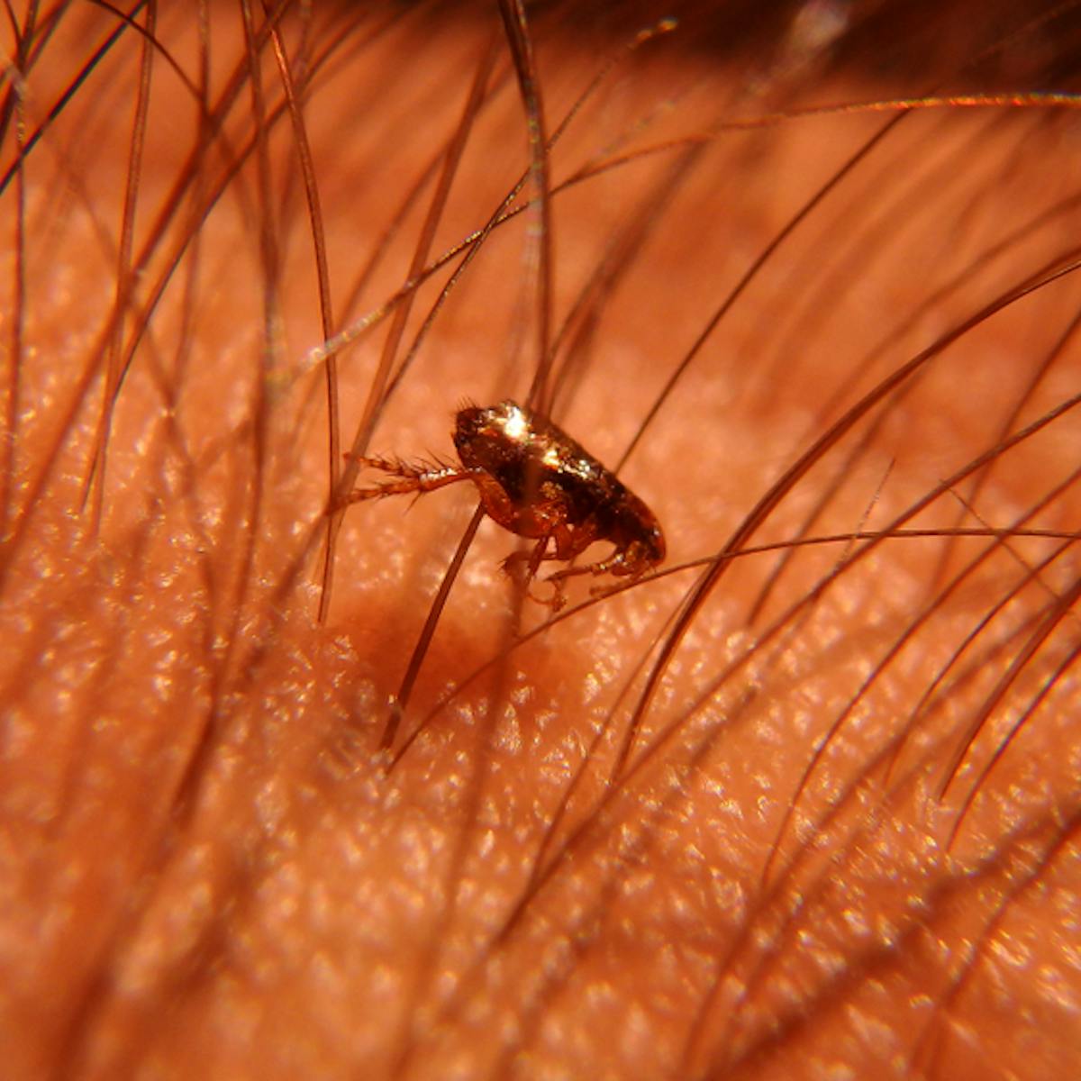 Sand Fleas Bites