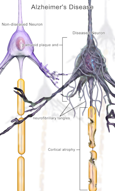 Advanced digital networks look a lot like the human nervous system