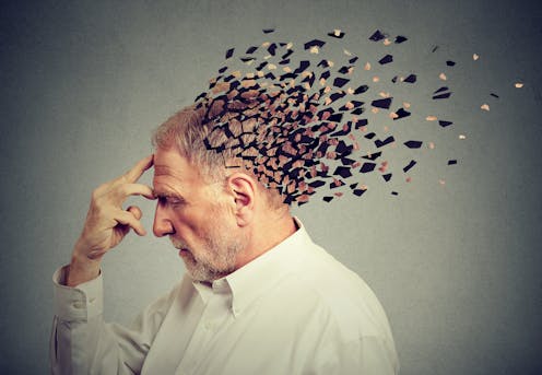 Es contagiosa la enfermedad de Alzheimer?