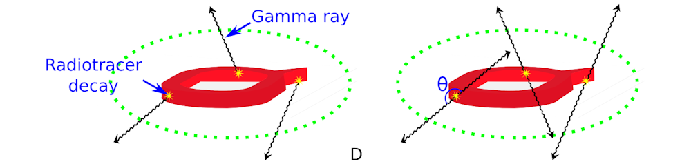 The science of medical imaging: SPECT and PET
