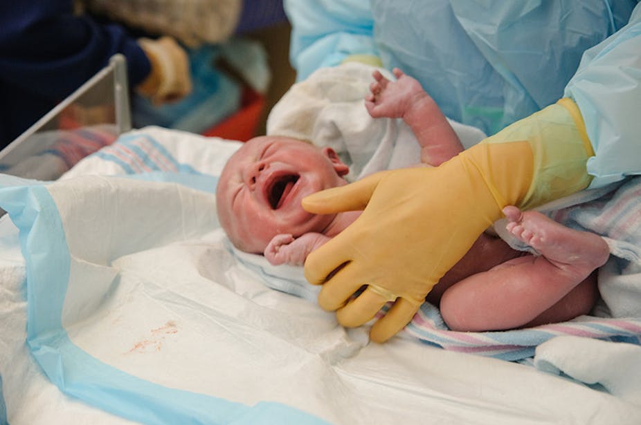 Unethical and harmful': the case against circumcising baby boys