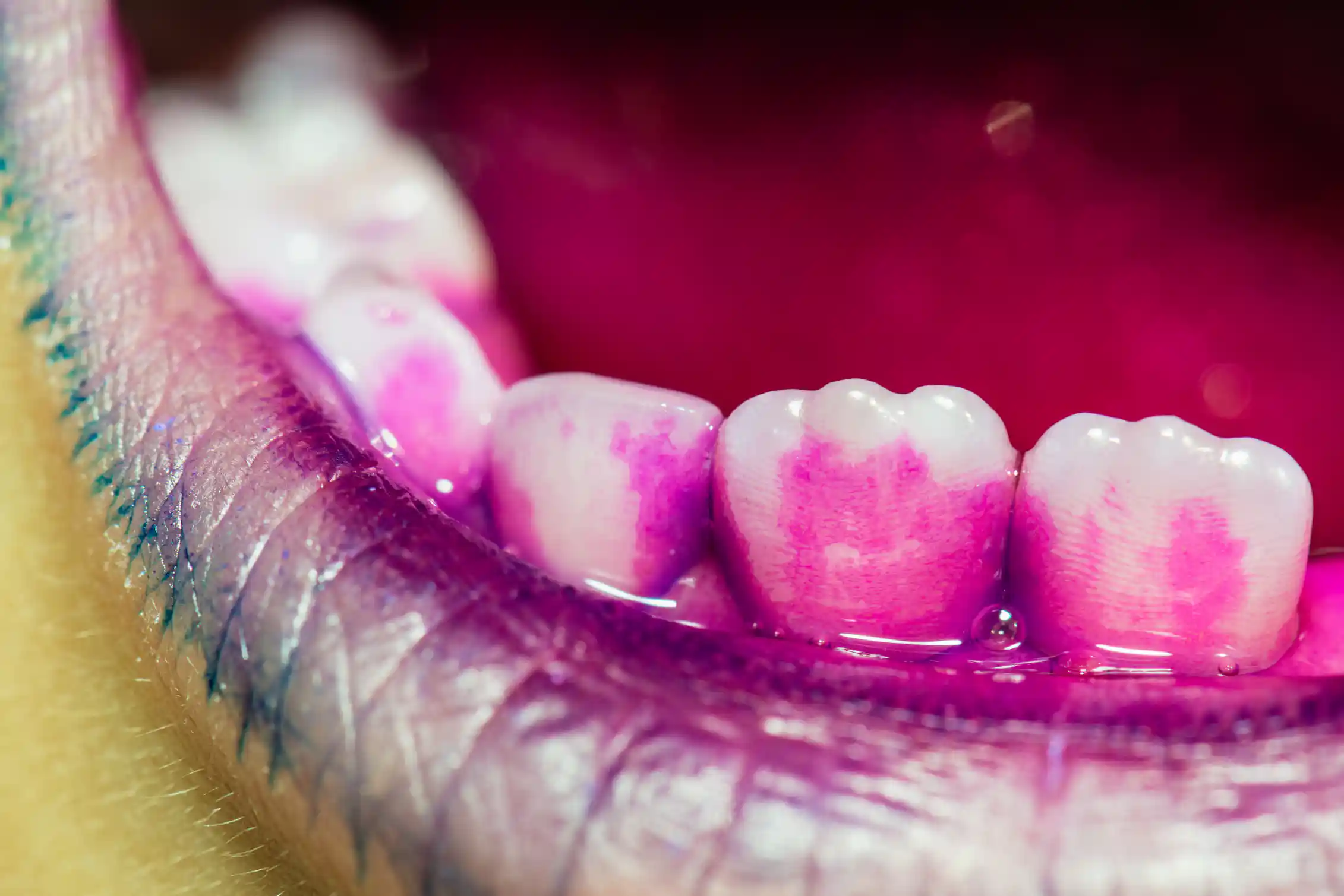 Pink Tooth You're probably brushing your teeth wrong – here are four tips for ...