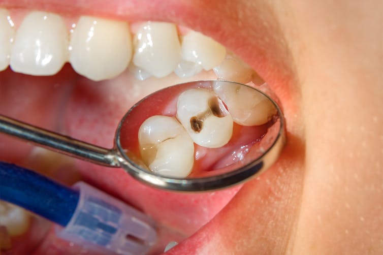 You're probably brushing your teeth wrong – here are four tips for better  dental health