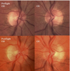 pre and post flight optic disc images