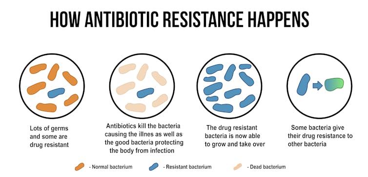 How to train the body's own cells to combat antibiotic resistance