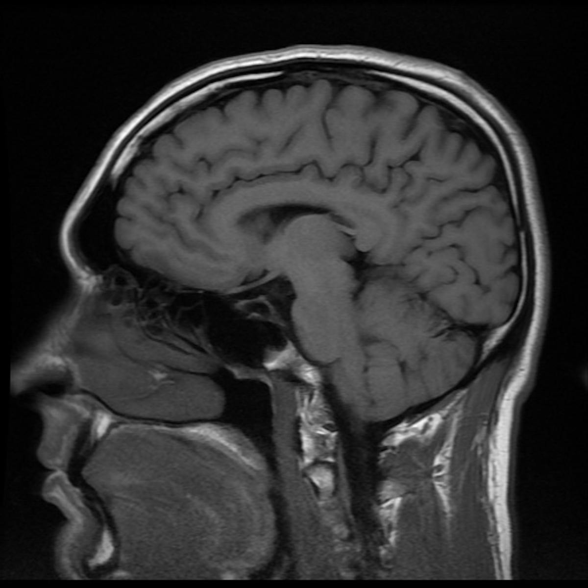Brain Scan Library Will Help Us Understand Normal Ageing Brain Scan Library Will Help Us Understand Normal Ageing