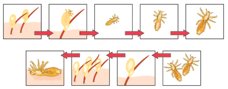 Back At School Here S How To Keep Kids Free Of Head Lice Back At School Here S How To Keep Kids Free Of Head Lice