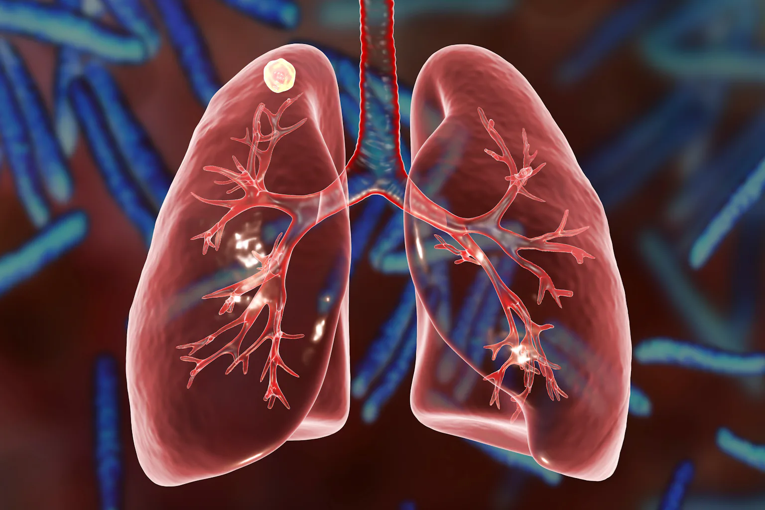 Tb Database Fighting tuberculosis: Databases are new and powerful weapons