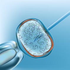 Considering using IVF to have a baby? Here's what you need to know