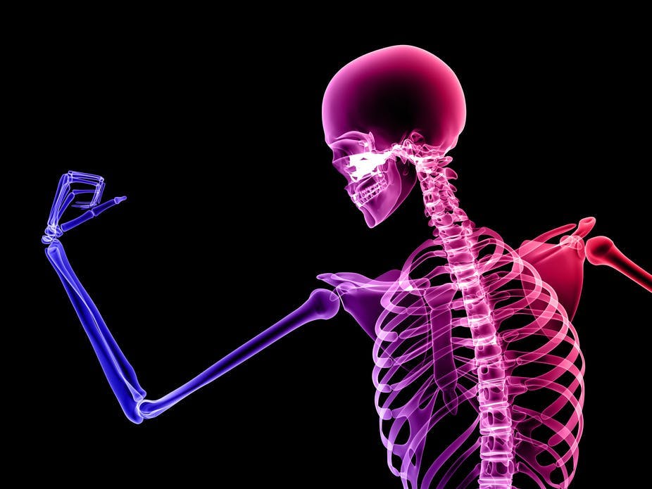Tulang kita lebih lemah dibanding tulang nenek moyang purba, apa yang bisa kita lakukan