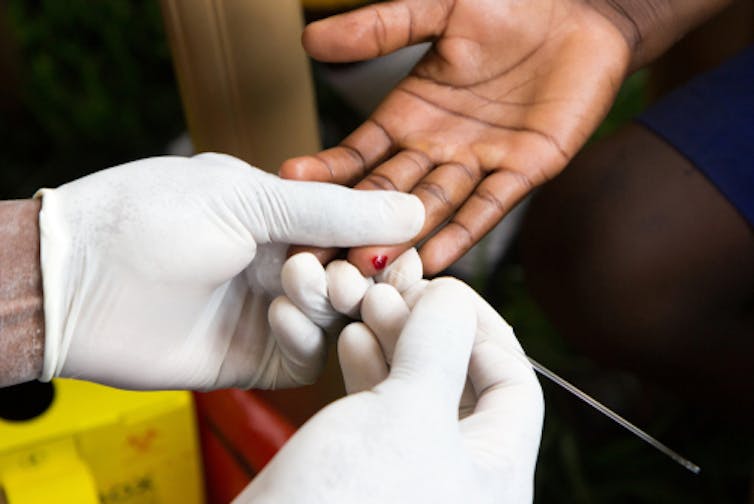 To end the HIV epidemic, addressing poverty and inequities one of most important treatments