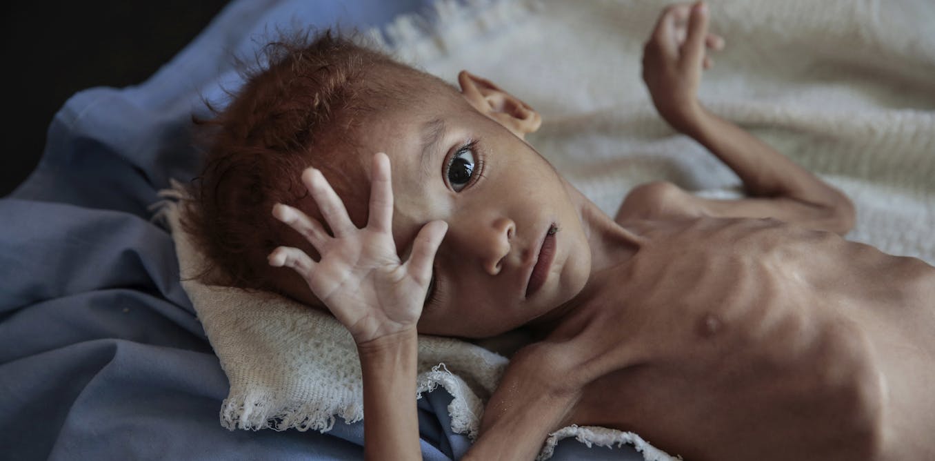 Senate vote could end us complicity in the saudi-led genocide in yemen