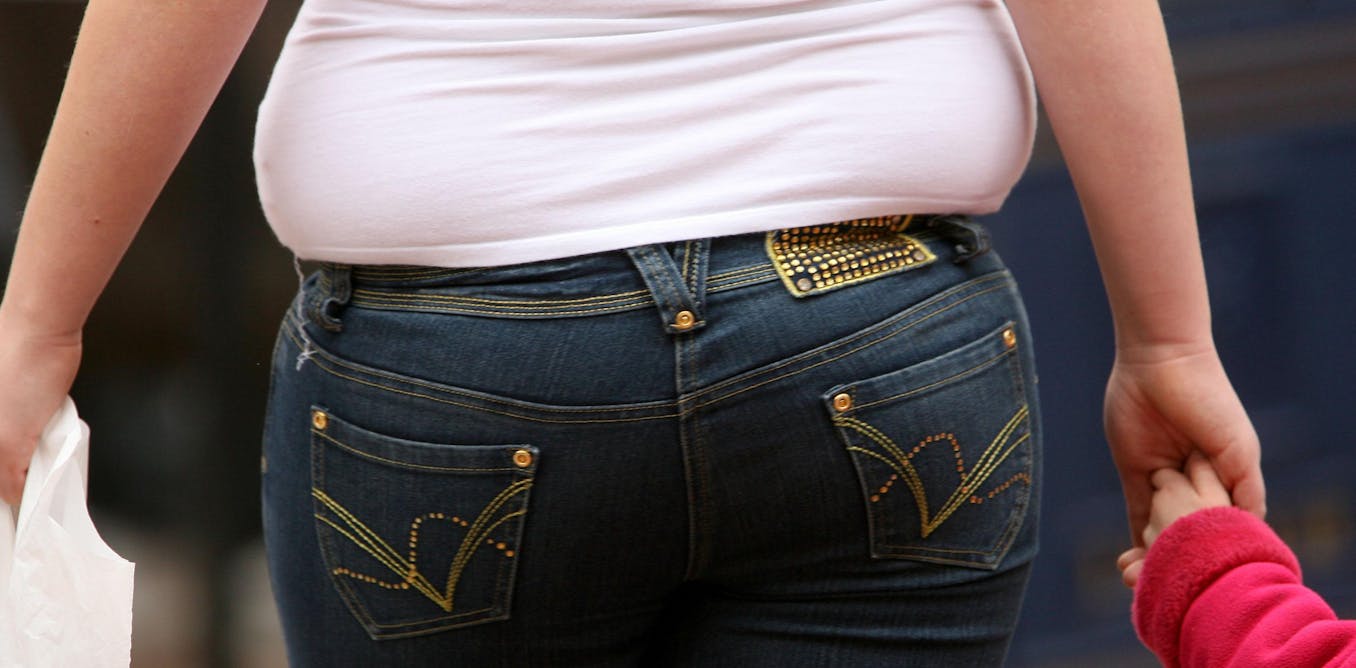 Time to face hard truths when it comes to obese children