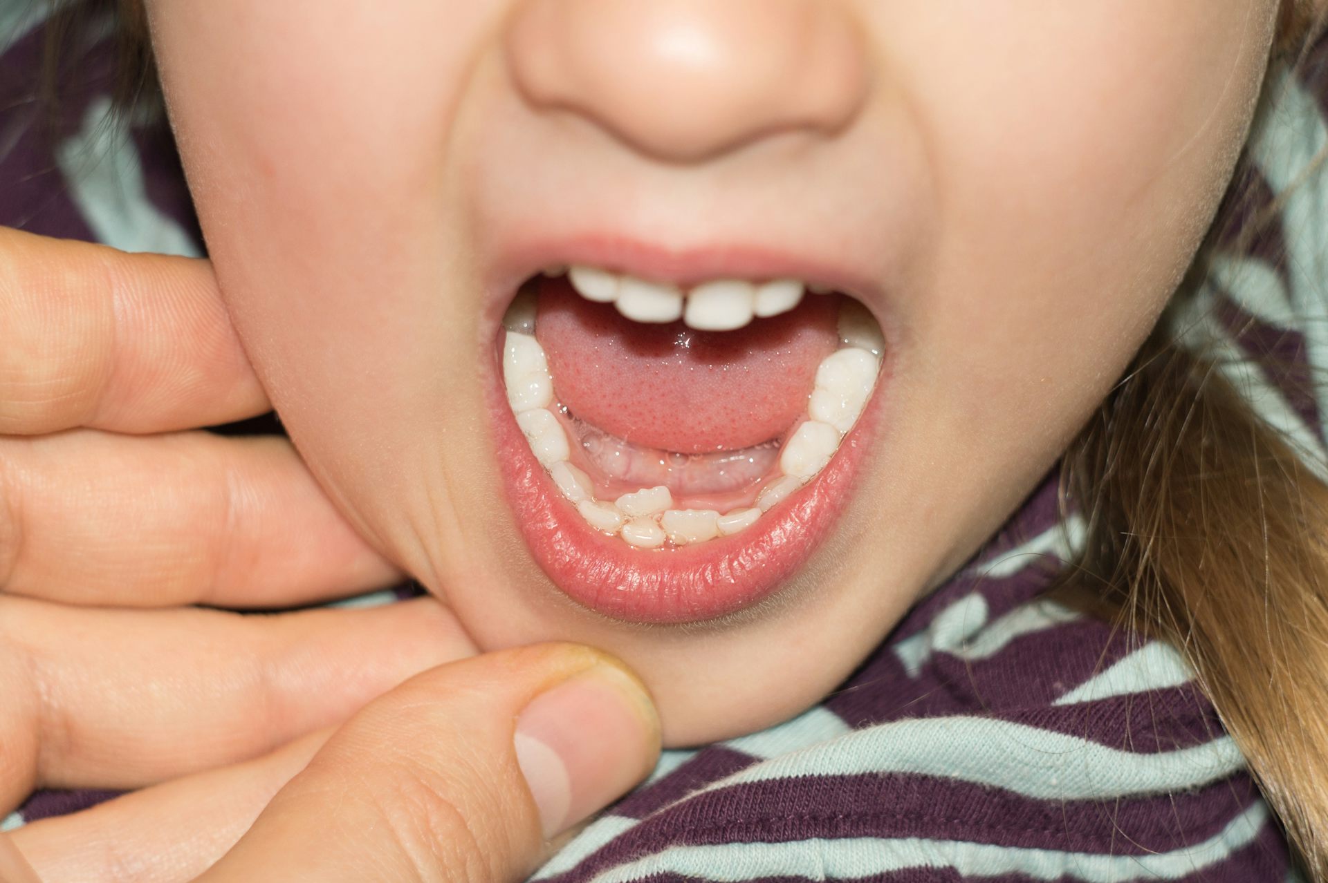 age lose first tooth