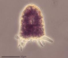 Amphizonella – identified in the authors’ sidewalk sample – has a soft protective layer | Matthew W. Brown, CC BY-ND