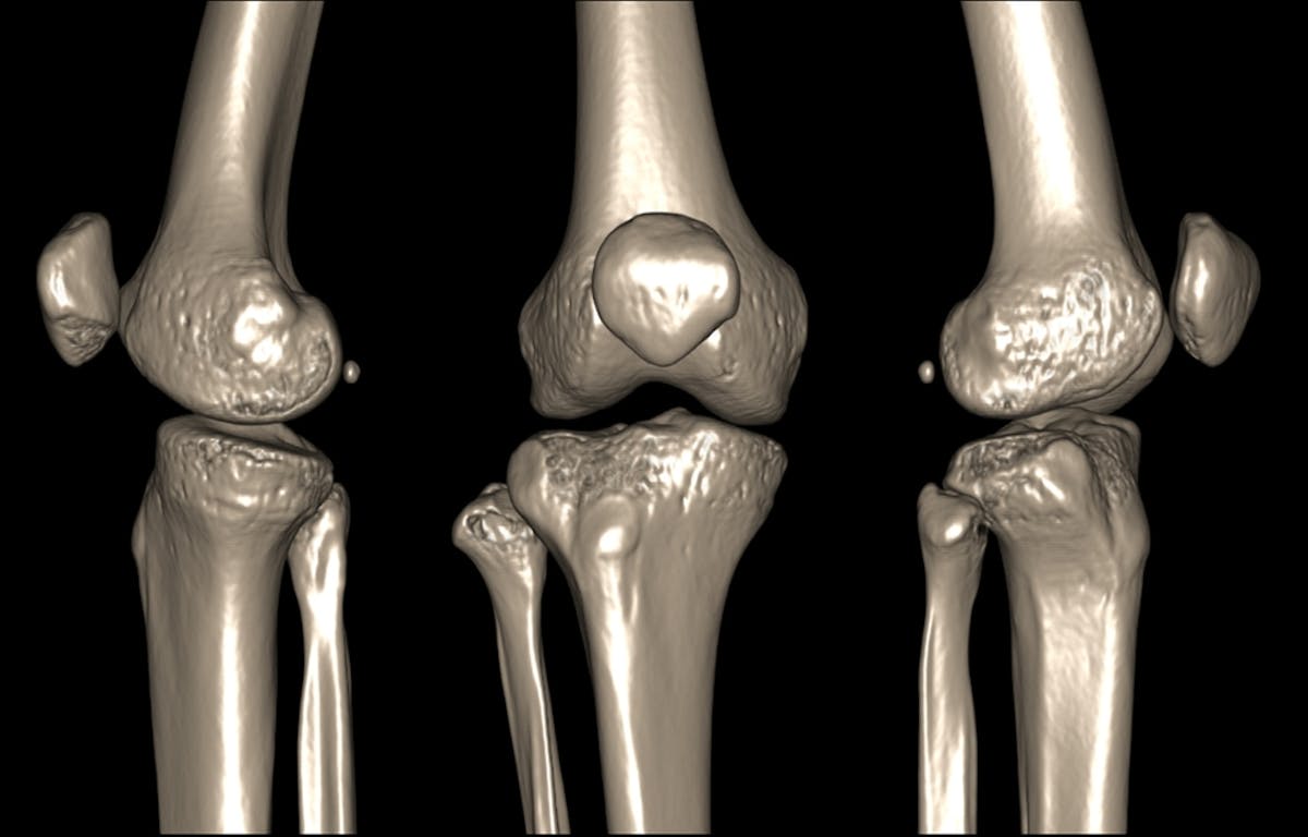 What Makes Joints Pop And Crack And Is It A Sign Of Disease