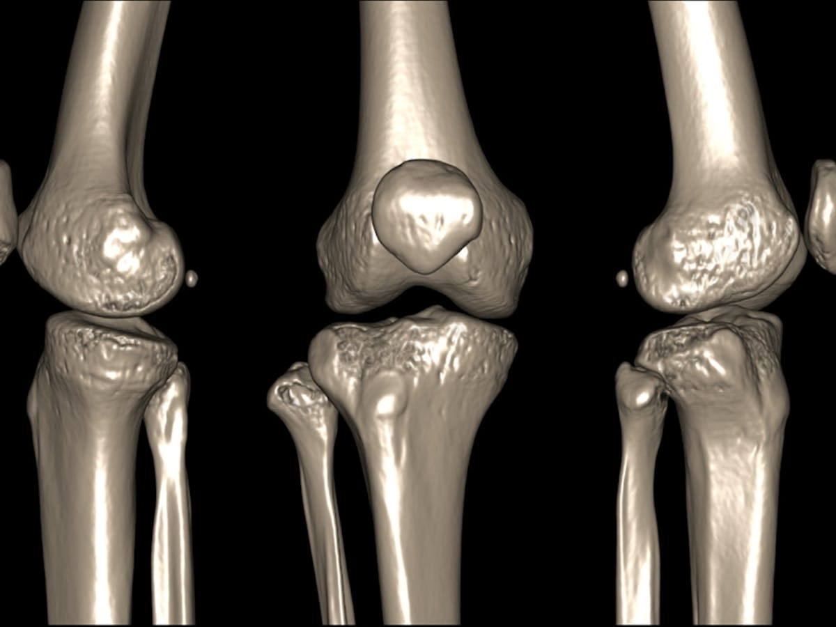 What makes joints pop and crack and is it a sign of disease? What makes joints pop and crack and is it a sign of disease?