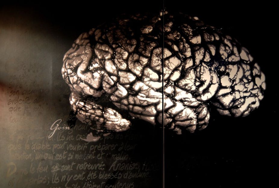 Téléchargement gratuit Images Stimuler Le Cerveau Pour Etre Plus Performant Est Il Reellement le plus cool salutations