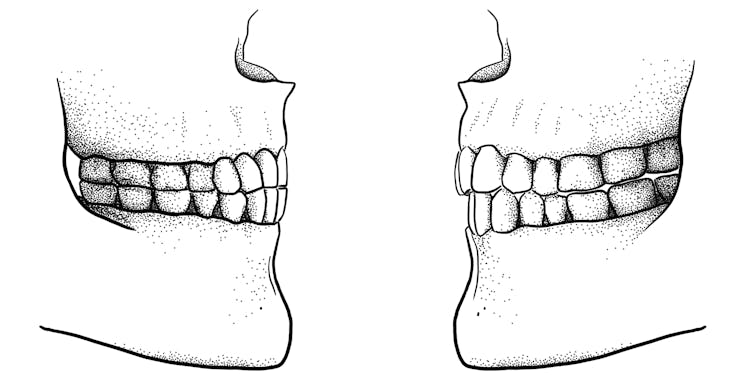 Softer, processed foods changed the way ancient humans spoke