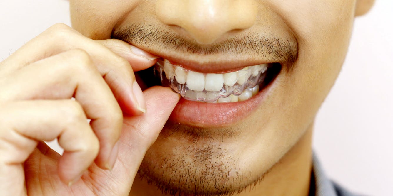 Eau oxygénée et dents : une solution alternative pour le blanchiment ?