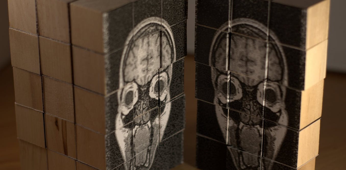 'Mental illness' isn't all about brain chemistry: it's about life