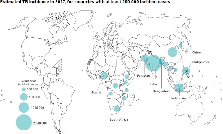 Tb Doesn T Only Attack The Lungs Other Organs Are Also Vulnerable